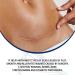 KLiHDSM Scar Removal Cream 30g - Stretch Marks & Surgical Skin Repair Gel for Whitening & Smoothing - Beauty Treatment for Scars and Burns - Buy Online on GoSupps.com