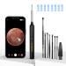 Ear Wax Removal Kit LMECHN Ear Cleaner with 1920P HD Camera Earwax Removal kit with 8 Pcs Ear Set Ear Cleaner with Camera and Light Ear Wax Removal Tool Camera for iPhone iPad Android Phones(Black)