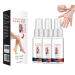 GBTJYRYC Vitiligo Removal Relief Spray Vitiligo Relief Spray Vitiligo Removal Reduces White Spots on Skin 3pcs