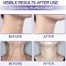 Tighten Neck Firming Cream Tighten And Lift Neck Cream Anti-Aging Neck Cream for Tightening Tighten and Lift Neck Cream Tightening Moisturizer for Neck - Buy Online on GoSupps.com