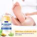 60% Urea & 2% Salicylic Acid Foot Cream - Deep Moisturizer for Dry Cracked Skin on Feet Knees Elbows & Hands - Exfoliates & Nourishes for Soft Smooth Skin - Unisex 1.41oz - Buy Online on GoSupps.com