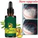 Hair Growth Serum Ginger Germinal Oil Anti Hair Loss Hair Serum Hair Loss and Thinning Hair Treatment Promotes Thicker Hair Growth - Buy Online on GoSupps.com