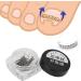 Ingrown Toe Wire Fixer 2 Box Fixer Toenail Correction Corrector Lifter Tool Nail Ingrowing Pedicure Care with 6 Sizes for Nail Toe Straighteners Recover Foot Care Men and Women - Buy Online on GoSupps.com