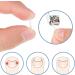 50 Pieces Ingrown Nails Feet Strips Corrector for Ingrown Nails Ingrown Toenails Ingrown Nails Ingrown Nails Feet Pedicure Tools for Foot Care for Men and Women - Buy Online on GoSupps.com