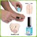 VYTALIVING BioClear Nail Doctor - Ingrown Toenail Treatment - Fungal Nail Treatment for Toenail Aids in Toe Nail Care | 15 ml - Buy Online on GoSupps.com