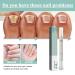 Nail Care Pen for Fungus - Aloe Vera Tea Tree Oil & Vitamin E | Nourish Fingernails & Toenails | International Shipping - Buy Online on GoSupps.com