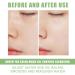 2 Pack Turmeric & Green Tea Clay Stick Face Masks - Organic Vitamin C, Blackhead Cleansing, Deep Pore Cleansing, Skin Brightening, Moisturizing - Buy Online on GoSupps.com