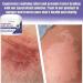 Pressure Sore Relief Healing Cream - Fast Absorption Moisturizing Formula for Wound Healing & Itch Relief | Soothing Redness & Promoting Healthy Skin - Buy Online on GoSupps.com