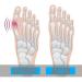 Unves Bunion Corrector for Men & Women - Hallux Valgus Splint & Pain Relief Sleeve (1 Pair) | International Shipping Available - Buy Online on GoSupps.com