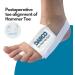Darco Low Profile Toe Brace - One Size White | Comfort & Support for Fast Recovery | International Shipping Available - Buy Online on GoSupps.com