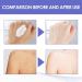 Crema Blanqueadora para Partes Intimas Aclarador de Axilas y Partes Intimas Blanqueador de Axilas y Partes Intimas Crema para Aclarar Las Axilas y Partes Intimas - 30ML/1.0 FL.Oz (1 PCS) - Buy Online on GoSupps.com