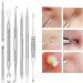Pimple Popper Tool Kit - 15PCS Blackhead Remover & Extraction Tools for Estheticians - Buy Online on GoSupps.com