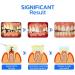 Propolis Oral Instant Treatment Spray 1/2/3/5 Pcs Propolis Oral Health Spray Propolis Oral Spray Fresh Breath (1PCS) - Buy Online on GoSupps.com