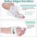 Adjustable Hallux Valgus Correction Rail for Big Toe Straightening - Unisex Day & Night Relief | Comfortable & Effective Solution - Buy Online on GoSupps.com