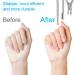 Sularpek 3-in-1 Cuticle Remover Tool Set - Professional Stainless Steel Nail Care Kit for Manicure and Pedicure - Buy Online on GoSupps.com