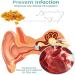 IEXUX Anti Cochlear Blockage Removal Spray - Earwax Removal Drops for Clogged Ears (3PCS) - Buy Online on GoSupps.com