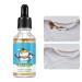 Besreey Laundry Stain Remover - Oil Stain Remover - 30ml Deep Cleaning Solution Odor Detergent Booster Removes Pet Stains Urine Odors Red Wine Grease Ink & Coffee Stains Fast
