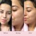 Saturday Skin Rub-a-Dub Refining Peel Gel 2.53 fl oz - Exfoliating Skincare for Radiant Skin - Buy Online on GoSupps.com