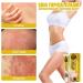 VEJIA Eczema Psoriasis Treatment Cream 20g - Dermatitis Pruritus Relief Ointment for Adults (3pcs) - Buy Online on GoSupps.com
