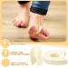 TrelaCo Foam Toe Separators - 30 Pcs Toe Spacers for Corn Relief & Pain from Bunions Toe Overlap Blisters & Hammer Toe - Buy Online on GoSupps.com