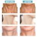 Neck Firming & Tightening Cream for Anti-Aging, Wrinkles, Double Chin & Turkey Neck - Skin Tightener & Crepe Skin Repair - Buy Online on GoSupps.com