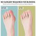 Bunion Corrector for Women & Men | 2-in-1 Adjustable Big Toe Relief Splints & Hammer Toe Straightener - Comfortable & Effective Double Correction Set - Buy Online on GoSupps.com