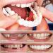 Instant Snap Veneers - Comfortable Flexible Dentures for a Perfect Smile | Top & Bottom Teeth Enhancement - Buy Online on GoSupps.com
