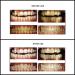 32LED Inductive Charging Teeth Whitening System - Accelerated Bleaching Trays Kit with 32 LED Lights (Black) - Buy Online on GoSupps.com