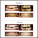 32LED Inductive Charging Teeth Whitening System - Accelerated Bleaching Trays Kit with 32 LED Lights (White) - Buy Online on GoSupps.com