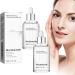 Niacinamide Freckles Removal Serum Niacinamide Spots Removal Serum Niacinamide Serum Nicotinamide Serum for Blemishes Niacinamide Serum for Face and Body for All Type Skin