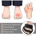 Adjustable Metatarsal Pads for Toe Support - 6pcs Ball of Foot Cushions for Hammer Toe, Claw Toes, Bunions - Men, Women - Buy Online on GoSupps.com