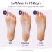 Exfoliating Foot Mask - 2 Pairs of Lavender & Roses Cornea Socks for Effective Foot Care | Unisex Dead Skin Remover - Buy Online on GoSupps.com