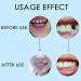 2 Pairs Adjustable Comfortable Teeth Aligners - Regain Your Confident Smile - Shop Internationally - Buy Online on GoSupps.com