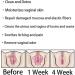 AnnieCare Instant Anti-Itch Detox Slimming Products - Firming Repair Capsules - Set of 2 - Buy Online on GoSupps.com