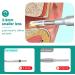 RKXKJ 7-Inch Ear Wax Removal Camera - 3.9mm Ear Scope with LED Light 2 Million Pixels - Safe for Children & Adults - Buy Online on GoSupps.com