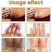 ALASSE Acantho Clear & Nigricare Therapy for Acanthosis Nigricans - Dark Spot & Skin Discoloration Treatment (2 Bottles) - Buy Online on GoSupps.com