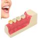 High Simulation Decomposition Model of Posterior Teeth 2x Magnification Educational Aid for Dental Studies - Buy Online on GoSupps.com