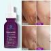20% Niacinamide Serum | Vitamin B3 Anti-Aging Moisturizer & Pore Minimizer | 30ml Concentrated Treatment - Buy Online on GoSupps.com