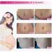 Scar Prevention & Stretch Mark Repair Essential Oil - Premium Beauty Solution for Women | Shop Now! - Buy Online on GoSupps.com