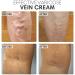 Buy Ttcpuysa Varicose Veins Cream - 2PCs Vein Healing Treatment Soothing Anti-Varicose Cream for Improved Blood Circulation (20g) - Buy Online on GoSupps.com