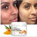 Lanthome Turmeric Face Cream - Anti-Aging Moisturizer for Skin, Acne Treatment, 50g - Buy Online on GoSupps.com