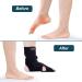 JOMECA Drop Foot Brace with Arch Support | Adjustable AFO for Walking | Medical Grade Orthosis Brace for Lower Limb Instability | MS, TBI, Stroke, Cerebral Palsy, Fracture Relief (Left X-Large) - Buy Online on GoSupps.com