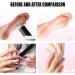 Cordless Electric Callus Remover for Feet with Nail File Sander 2 in 1 Rechargeable Foot File Grinder for Dead Skin Crack Dry Calluses with Sandpaper Disk 6 Speed Adjustable Black - Buy Online on GoSupps.com