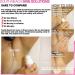 South Beach Skin Solutions: Underarm Skin Bleaching & Lightening - Dark Spot Corrector for Private Areas - Buy Online on GoSupps.com