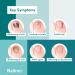 Nailner 2-in-1 Fungal Nail Treatment Brush - 5 ml for Healthy, Bright Nails - Buy Online on GoSupps.com