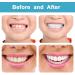 Temporary Snap-On Denture Teeth for Men & Women | Fix Your Smile with Perfect Fit Fake Teeth - Buy Online on GoSupps.com