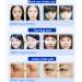 Adofect Collagen Eye Mask - 30 Pairs, Moisturizing, Wrinkle & Dark Circle Treatment - Buy Online on GoSupps.com