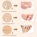 107PCS Ingrown Toenail Removal Kit - Toe Nail Corrector Tool for Pain Relief & Correcting Ingrown Toenails - Buy Online on GoSupps.com