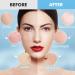 Poztl Gele Mask Powder - Hydrating Peel-Off Hydro-Facial Mask with Hyaluronic Acid | Anti-Aging Treatment for Fine Lines - Buy Online on GoSupps.com