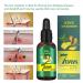 Hair Growth Serum - Natural Hair Loss Treatment & Stimulates New Growth (30ml) | International Shipping - Buy Online on GoSupps.com